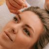 Facial acupuncture | Treatwell