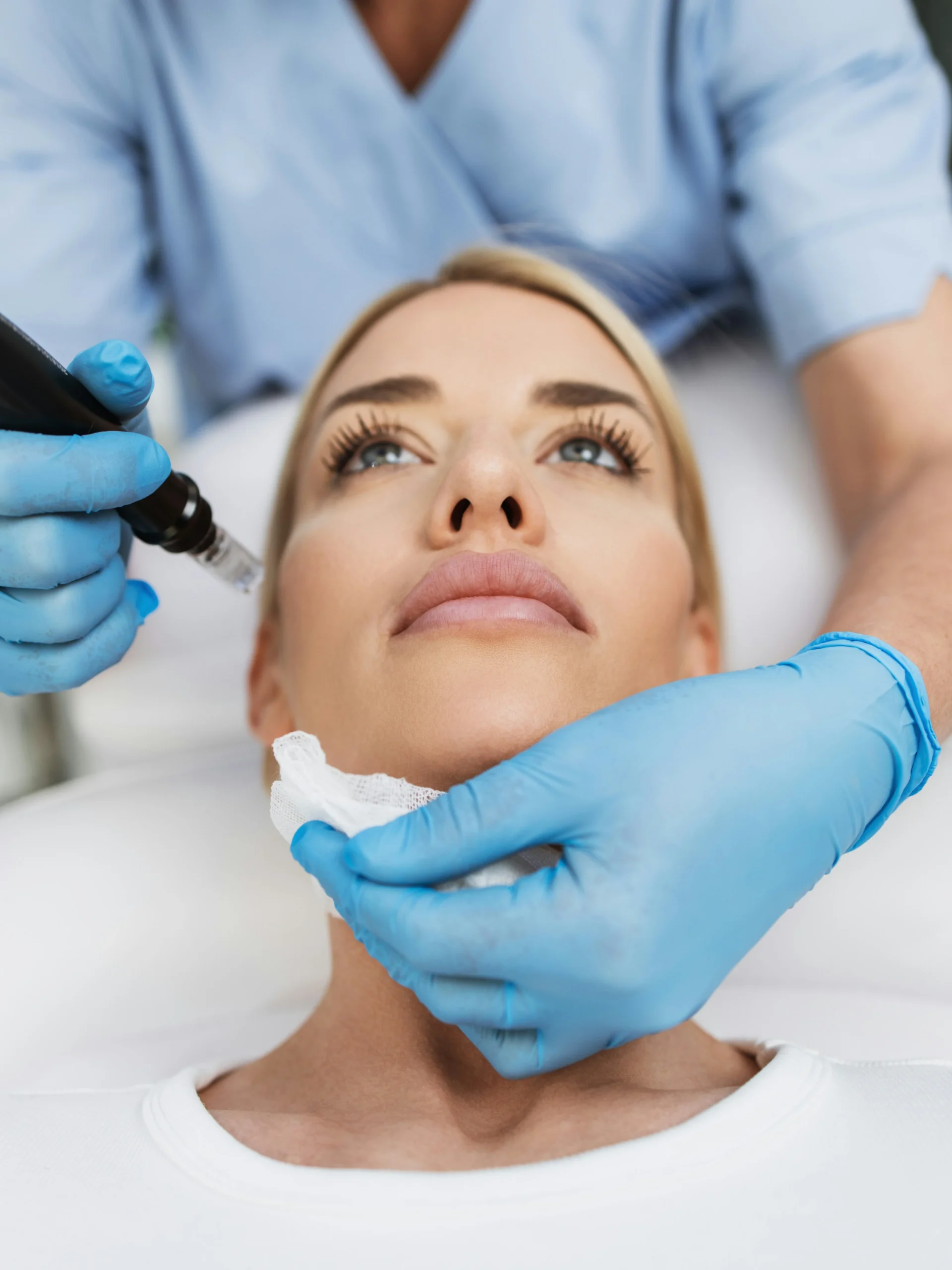 A close-up of a woman’s face as she relaxes on a treatment bed and receives microneedling treatment in a clinic